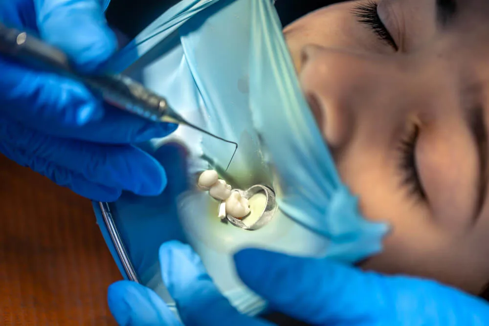 Bone Grafting Application