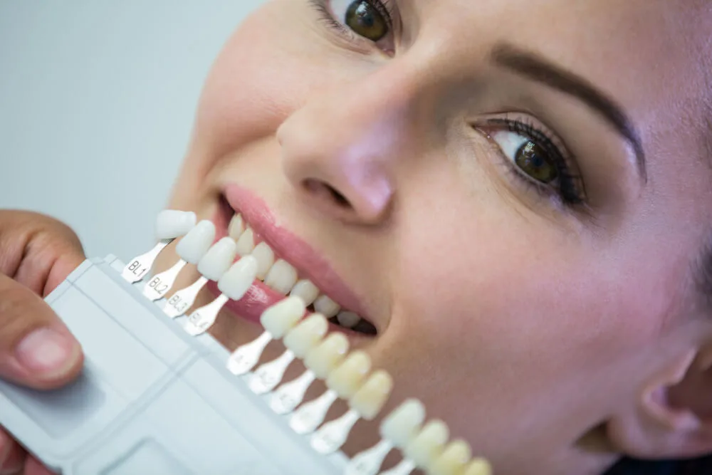 Dental Implants
